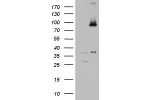 Western Blotting (WB) image for anti-ATP-Binding Cassette, Sub-Family D (Ald), Member 1 (ABCD1) (AA 508-745) antibody (ABIN2715622) (ABCD1 抗体  (AA 508-745))