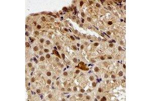 Immunohistochemical analysis of Periplakin staining in rat kidney formalin fixed paraffin embedded tissue section. (PPL 抗体)