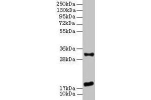 Western Blot All lanes: EMP3 antibody at 3 μg/mL + Mouse heart tissue Secondary Goat polyclonal to rabbit IgG at 1/10000 dilution Predicted band size: 19 kDa Observed band size: 19, 31 kDa (EMP3 抗体  (AA 25-65))