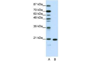 WB Suggested Anti-RPL9 Antibody Titration:  1. (RPL9 抗体  (C-Term))