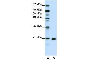 WB Suggested Anti-RPL9 Antibody Titration:  1.