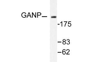 Image no. 1 for anti-Minichromosome Maintenance Complex Component 3 Associated Protein (MCM3AP) antibody (ABIN265431) (GANP 抗体)