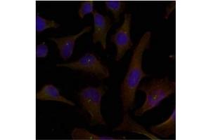 Image no. 2 for anti-Docking Protein 1, 62kDa (Downstream of tyrosine Kinase 1) (DOK1) (Tyr398) antibody (ABIN197538)