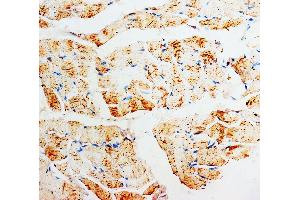 Anti-PMVK antibody, IHC(P) IHC(P): Rat Skeletal Muscle Tissue (PMVK 抗体  (Middle Region))