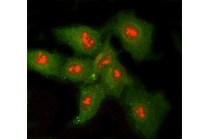 IF analysis of RNASEH1 and Tubulin beta using anti-RNASEH1 antibody (ABIN7602317) and anti-Tubulin beta antibody (ABIN7602744). (Ribonuclease H1 抗体  (AA 7-223))