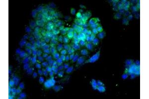 Immunofluorescence (Cultured Cells) (IF (cc)) image for anti-Protein tyrosine Phosphatase, Non-Receptor Type 1 (PTPN1) (AA 1-100) antibody (ABIN725975)
