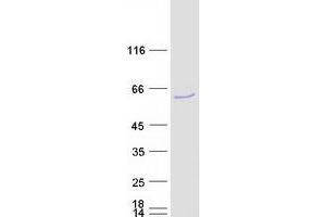Validation with Western Blot