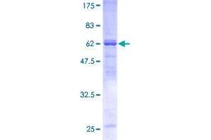 Sorting Nexin 7 Protein (SNX7) (AA 1-336) (GST tag)