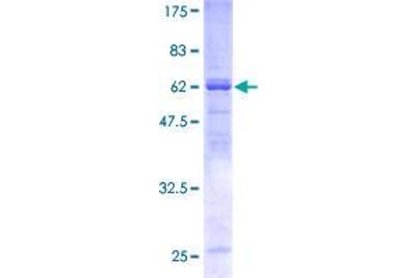 Sorting Nexin 7 Protein (SNX7) (AA 1-336) (GST tag)