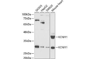 Western blot analysis of extracts of various cell lines, using KCNJ11 antibody (ABIN6129430, ABIN6142721, ABIN6142722 and ABIN6221442) at 1:1000 dilution. (KCNJ11 抗体  (AA 171-390))