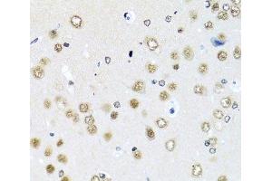 Immunohistochemistry of paraffin-embedded Rat brain using RAB3IP Polyclonal Antibody at dilution of 1:100 (40x lens). (RAB3IP 抗体)