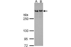 WB Image 53BP1 antibody [N1], N-term detects TP53BP1 protein by Western blot analysis. (TP53BP1 抗体  (N-Term))