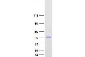 Western Blotting (WB) image for Carbonic Anhydrase VA (CA5A) protein (Myc-DYKDDDDK Tag) (ABIN2713131)