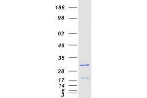 Western Blotting (WB) image for Sorting Nexin 10 (SNX10) protein (Myc-DYKDDDDK Tag) (ABIN2732381)