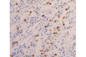 Immunohistochemistry (IHC) image for anti-Pituitary Tumor-Transforming 1 (PTTG1) (AA 2-202) antibody (ABIN5014129)