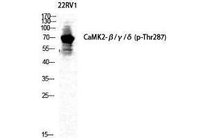 Western Blotting (WB) image for anti-CaMKIIbeta/gamma/delta (pThr287) antibody (ABIN3182661) (CaMKIIbeta/gamma/delta 抗体  (pThr287))