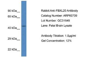 Western Blotting (WB) image for anti-F-Box and Leucine-Rich Repeat Protein 20 (FBXL20) (N-Term) antibody (ABIN2788548) (FBXL20 抗体  (N-Term))