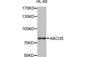 Western blot analysis of extracts of HL-60  cells, using ABCG5 antibody. (ABCG5 抗体)