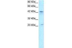 WB Suggested Anti-ZNF365 Antibody Titration: 0. (ZNF365 抗体  (N-Term))