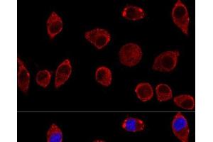 Confocal immunofluorescence analysis of L929 cells using DAO Polyclonal Antibody at dilution of 1:100. (D Amino Acid Oxidase 抗体)