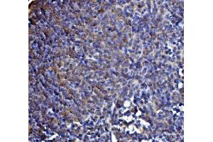 IHC analysis of DLST using anti-DLST antibody (ABIN7599412). (DLST 抗体  (AA 1-453))