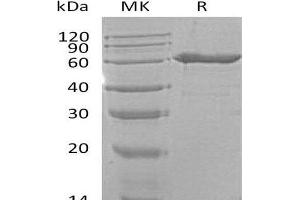 5'-Nucleotidase, Ecto (CD73) (NT5E) protein (His tag)