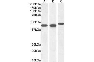 Western Blotting (WB) image for anti-Actin, alpha 2, Smooth Muscle, Aorta (ACTA2) (N-Term) antibody (ABIN185271)