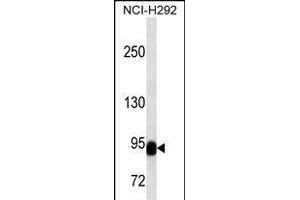 BCL6 Antibody (C-term) (ABIN1536594 and ABIN2843796) western blot analysis in NCI- cell line lysates (35 μg/lane). (BCL6 抗体  (C-Term))