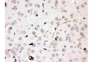 IHC analysis of Ceruloplasmin/CP using anti-Ceruloplasmin/CP antibody (ABIN3044508). (Ceruloplasmin 抗体  (AA 20-258))