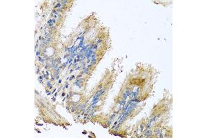Immunohistochemistry of paraffin-embedded human trachea using COX6B1 antibody at dilution of 1:100 (x40 lens). (COX6B1 抗体)