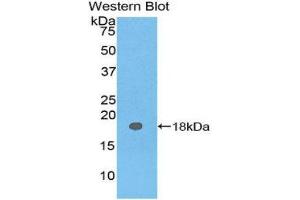 Western Blotting (WB) image for anti-Carcinoembryonic Antigen Gene Family (CEA) (AA 93-221) antibody (ABIN1077898) (CEA 抗体  (AA 93-221))