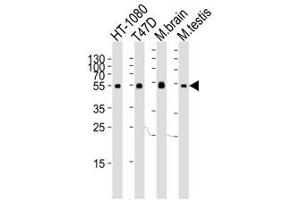 Western blot analysis of lysate from HT-1080, T47D cell line, mouse brain and testis tissue lysate using TUBA6 antibody at 1:1000. (TUBA1C 抗体  (N-Term))