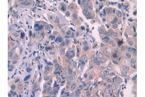 Immunohistochemistry (IHC) image for anti-2',5'-Oligoadenylate Synthetase 1, 40/46kDa (OAS1) (AA 74-165) antibody (ABIN7435079)