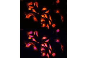 Immunofluorescence analysis of U-2 OS cells using L Polyclonal Antibody (ABIN6133274, ABIN6143083, ABIN6143084 and ABIN6215309) at dilution of 1:100 (40x lens). (LAMTOR1 抗体  (AA 1-161))