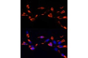 Immunofluorescence analysis of NIH/3T3 cells using MCTS1 antibody (ABIN6132341, ABIN6143657, ABIN6143658 and ABIN6224877) at dilution of 1:100 (40x lens).