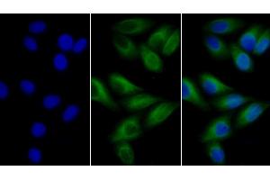Detection of TUBb in Human MCF7 cell using Anti-Tubulin Beta (TUBb) Monoclonal Antibody (TUBB 抗体  (AA 170-419))