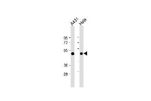 All lanes : Anti-RAD9 Antibody (BH3 Domain Specific) at 1:4000 dilution Lane 1: A431 whole cell lysate Lane 2: Hela whole cell lysate Lysates/proteins at 20 μg per lane.