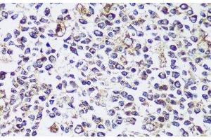Immunohistochemistry of paraffin-embedded Human tonsil using ECH1 Polyclonal Antibody at dilution of 1:150 (40x lens). (ECH1 抗体)