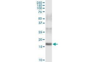 Immunoprecipitation of PLA2G16 transfected lysate using rabbit polyclonal anti-PLA2G16 and Protein A Magnetic Bead (PLA2G16 (人) IP-WB Antibody Pair)