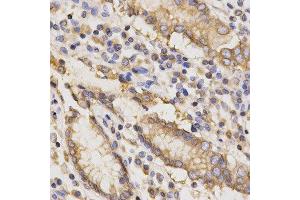 Immunohistochemistry (IHC) image for anti-TAP Binding Protein (Tapasin) (TAPBP) antibody (ABIN1875423) (TAPBP 抗体)