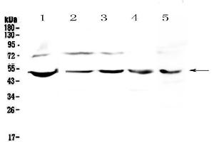 Western blot analysis of ESRRG using anti-ESRRG antibody . (ESRRG 抗体  (AA 302-458))