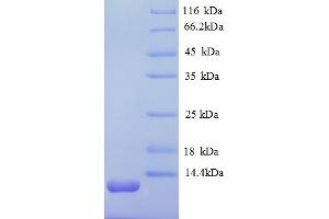 SDS-PAGE (SDS) image for Chemokine (C-X-C Motif) Ligand 12 (CXCL12) (AA 22-89), (partial) protein (His tag) (ABIN5712676) (CXCL12 Protein (AA 22-89, partial) (His tag))