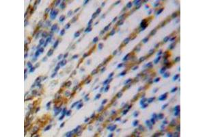 Used in DAB staining on fromalin fixed paraffin- embedded kidney tissue (SPRY2 抗体  (AA 116-305))