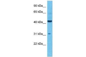 Host:  Rabbit  Target Name:  KCNK4  Sample Type:  Colorectal Tumor lysates  Antibody Dilution:  1. (KCNK4 抗体  (N-Term))