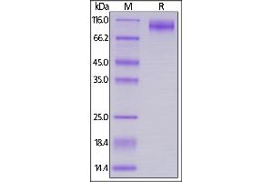 Biotinylated HIV-1 [HIV-1/Clade B/C (CN54)] GP120, His,Avitag on  under reducing (R) condition. (Human Immunodeficiency Virus Surface Glycoprotein (HIV gp120) (AA 36-507) (Active) protein (His tag,AVI tag,Biotin))
