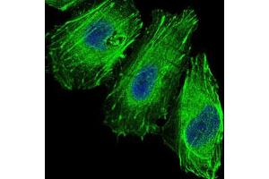 Image no. 1 for anti-Forkhead Box O1 (FOXO1) antibody (ABIN1498297) (FOXO1 抗体)