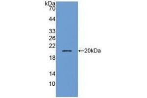 Detection of Recombinant ADM, Human using Polyclonal Antibody to Adrenomedullin (ADM) (Adrenomedullin 抗体  (AA 22-147))