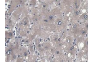 Immunohistochemistry (IHC) image for anti-ER Lipid Raft Associated 2 (ERLIN2) (AA 47-339) antibody (ABIN7441649)