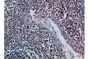Immunohistochemical analysis of paraffin-embedded Human-tonsil, antibody was diluted at 1:100 (GZMM 抗体  (AA 207-256))