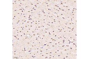 Immunohistochemistry (Paraffin-embedded Sections) (IHC (p)) image for anti-Ubiquitin Specific Peptidase 24 (USP24) antibody (ABIN7076111)